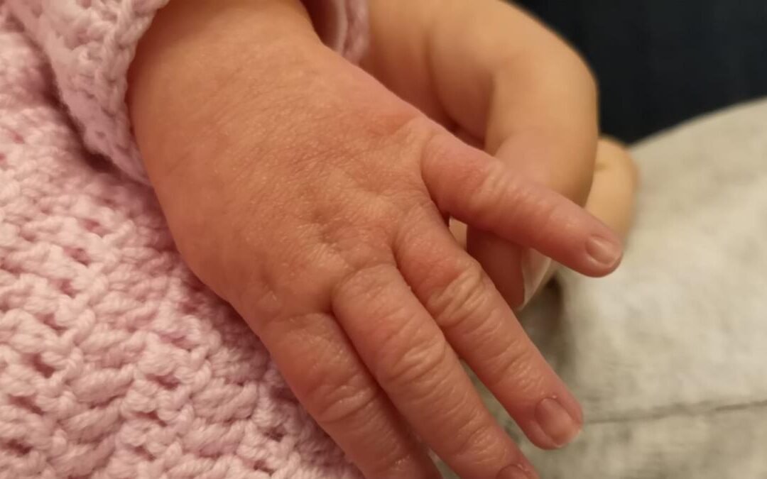 Bebé de 10 meses muere tras sobredosis de fentanilo