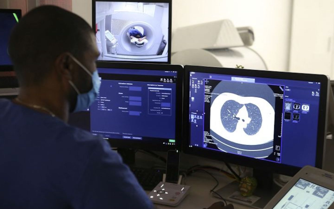 Aumentan tasas de supervivencia del cáncer de pulmón en EEUU