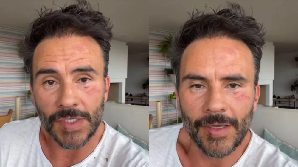 Golpearon y robaron al actor Juan Pablo Raba en Bogotá