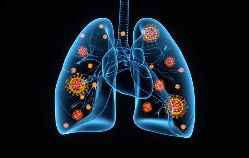 Casos de influenza van en aumento en EEUU, Florida con niveles muy altos