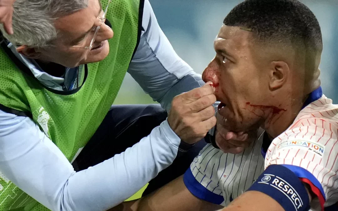 Mbappé se fracturó la nariz en la Eurocopa 2024