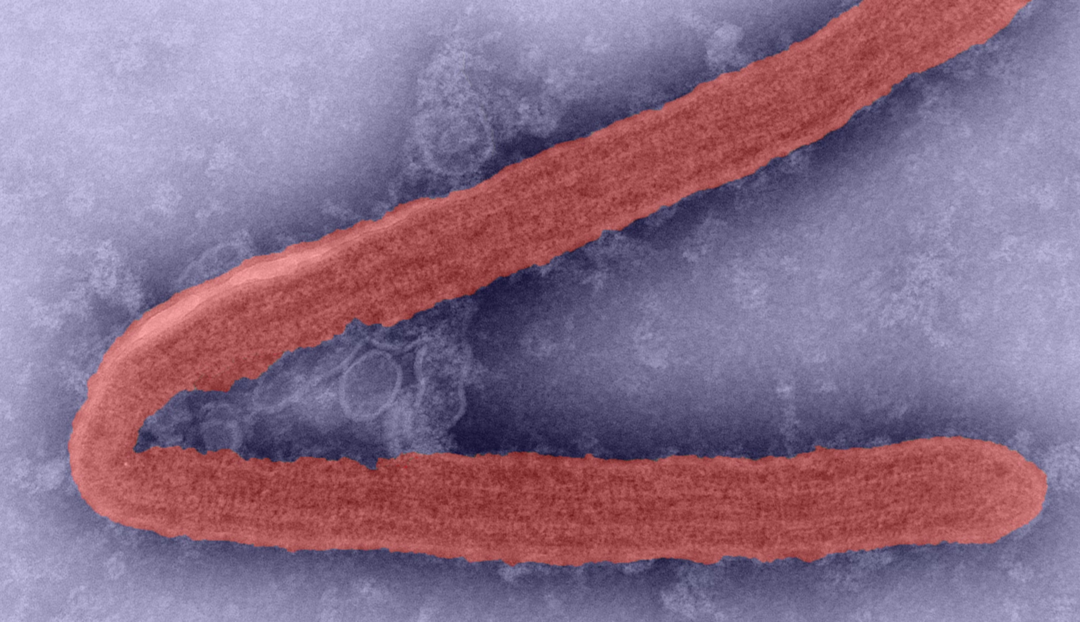 OMS en alerta por la propagación del virus de Marburgo